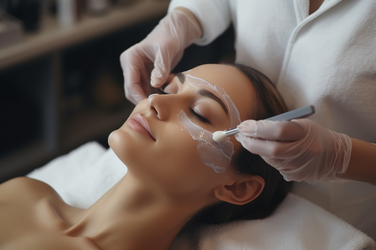 Chemical Peel